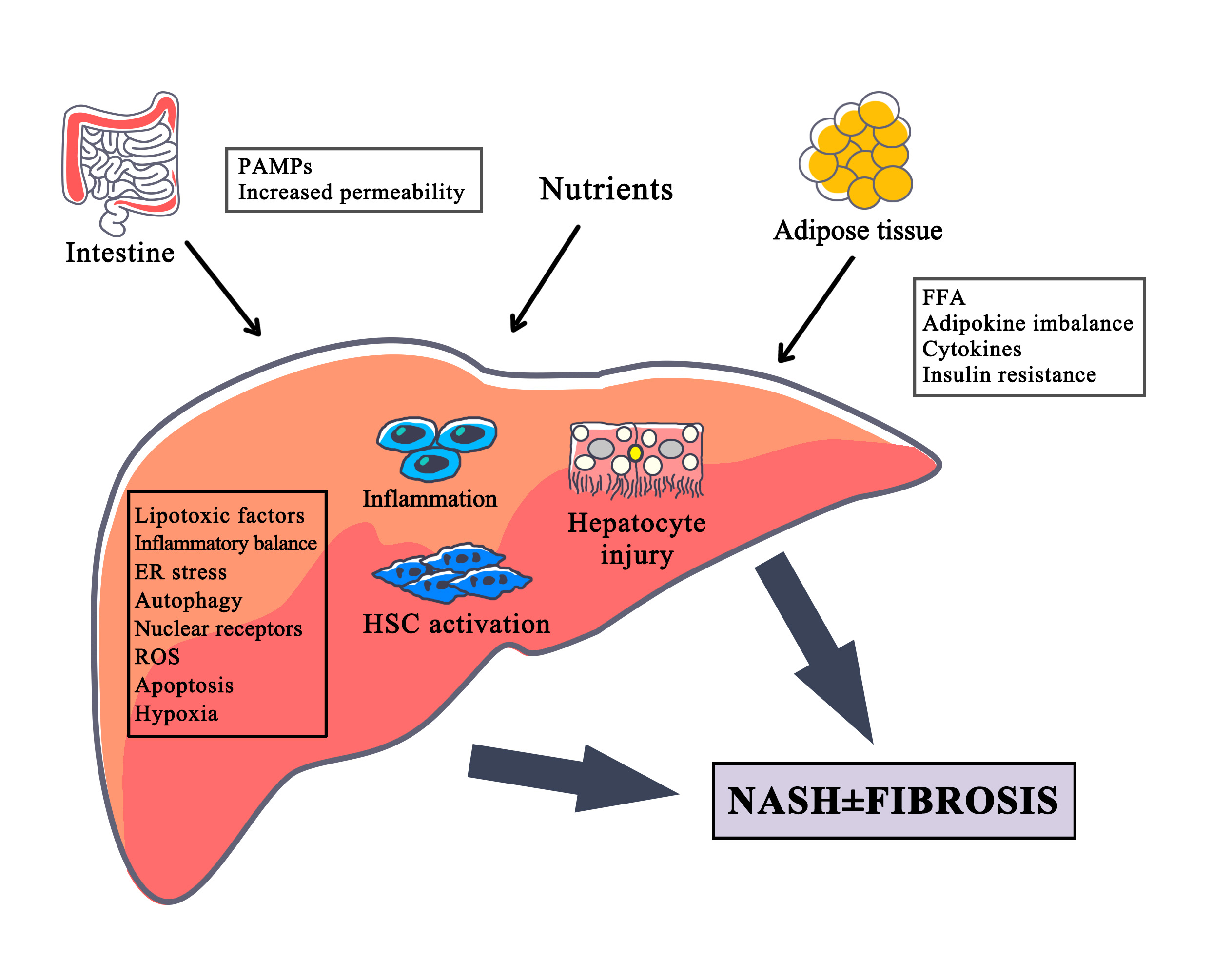 Nonalcoholic steatohepatitis（NASH）